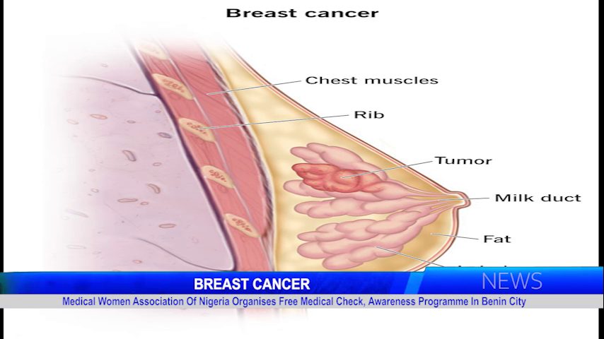 BREAST CANCER: Medical Women Association Of Nigeria Organises Free Medical Check, Awareness Programme In Benin City