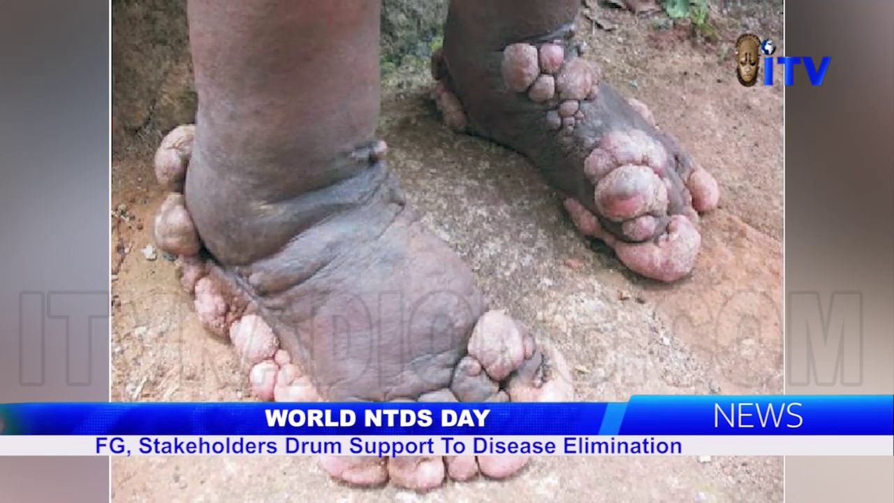 World NTDS Day: FG, Stakeholders Drum Support To Disease Elimination